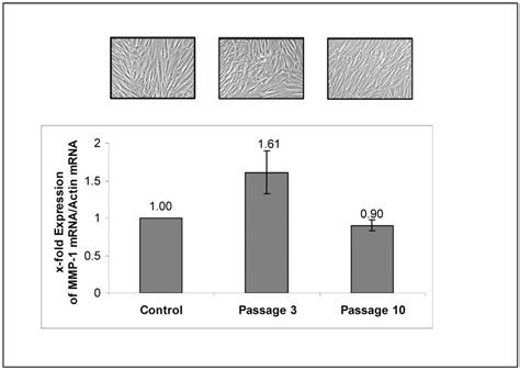 Quantitative Real Time Rt Pcr Analysis Of Mmp 1 Mrna Expression After