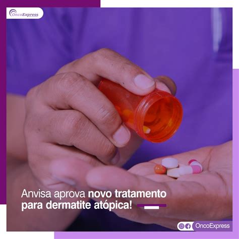 Anvisa aprova novo tratamento para dermatite atópica OncoExpress