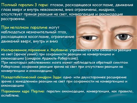 Черепно-мозговые нервы. I-VI пары - презентация онлайн