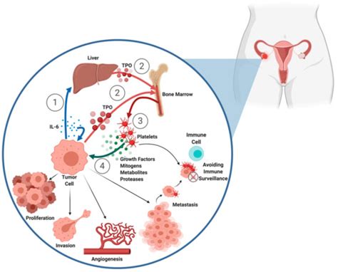 Ijms Free Full Text Platelets Thrombocytosis And Ovarian Cancer