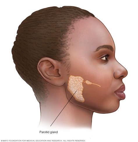 Parotid Tumors Overview Mayo Clinic