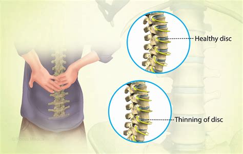 Health Condition : Symptoms, Causes, Treatment and More