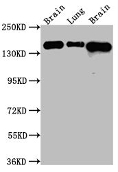 Anti Homo Sapiens Human Fgfr Recombinant Monoclonal Antibody Cusabio