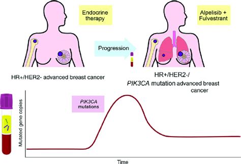 Clinical use of ctDNA to guide novel treatment line in HRþ, HER2À ...