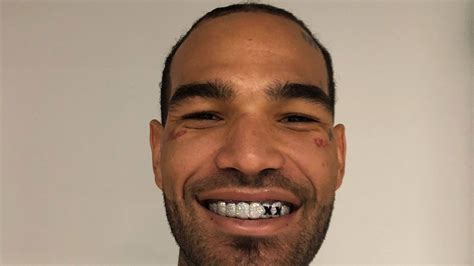 Willie Cauley Stein Teeth X Wallpaper Teahub Io