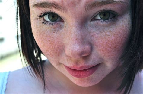 Freckles Mary Roney Flickr