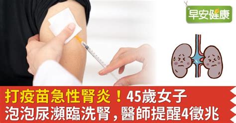 打疫苗急性腎炎！45歲女子泡泡尿瀕臨洗腎，醫師提醒4徵兆