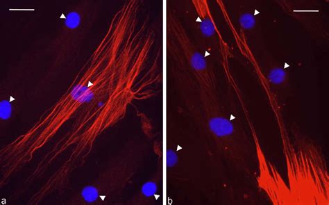 Double Label Immunofluorescence Microscopy Of An Msc Culture Grown To Download Scientific