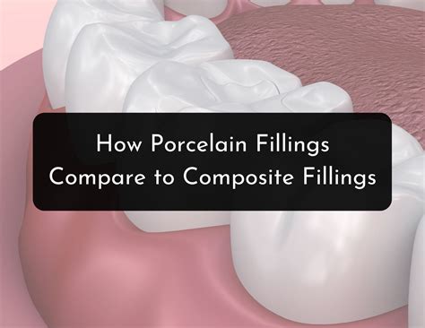 Porcelain Fillings vs Composite Fillings Comparison