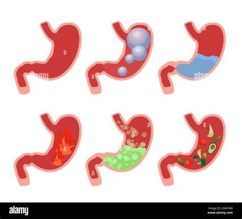 stomach pain anatomy medical stock vector images alamy