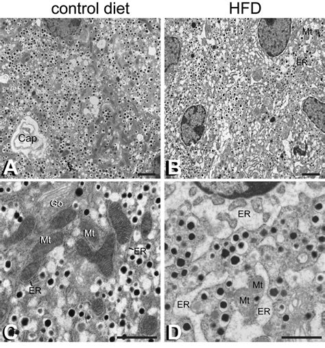 Cell Ultrastructural Changes Assessed By Em Microscopy Following