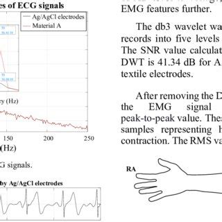 Placement of electrodes for EMG measurement. | Download Scientific Diagram