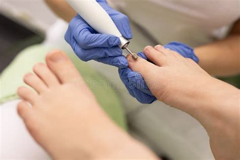 Patient On Medical Pedicure Procedure Stock Photo Image Of Fingernail