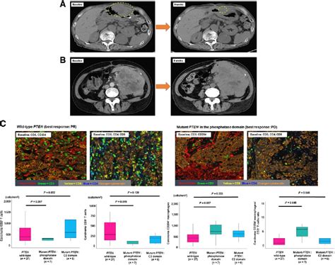 Figure From A Low Tumor Mutational Burden And Pten Mutations Are