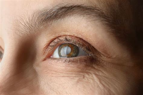 Cataract Surgery What You Need To Know Advanced Eye Surgeons