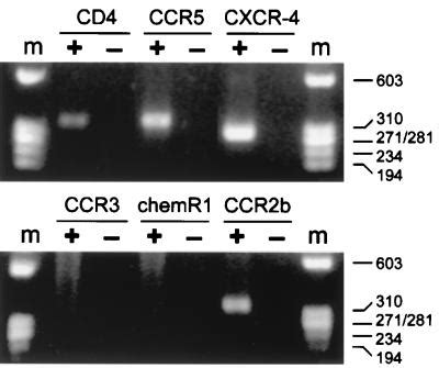 CXCR 4 Is Expressed By Primary Macrophages And Supports CCR5