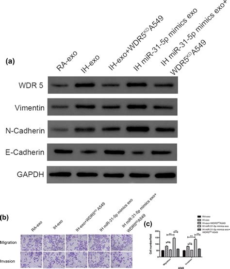 Exosomal Mir P Promoted Luad Cells Migration And Invasion By