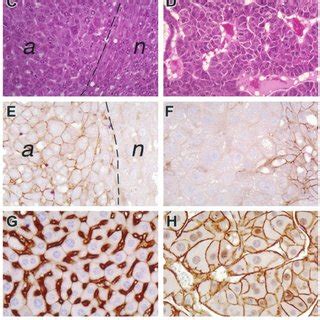 Histological and genetic analyses of liver tumors in PARP 1 Ϫ Ϫ Ku80