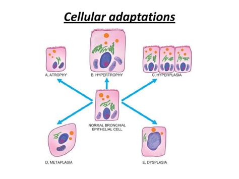 Neoplasia Characteristics And Classification Of Cancer Ppt