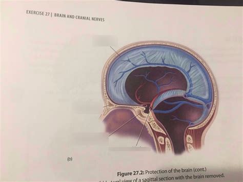 Brain 3 Diagram Quizlet