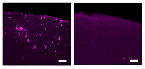 Hz Vibrations Reduce Alzheimers Pathology Symptoms In Mouse Models