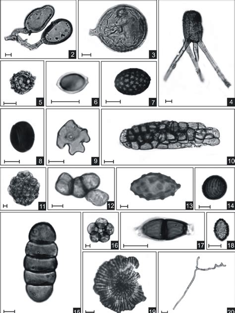 Fotomicrografias De Palinomorfos Selecionados 2 3 Glomus 4