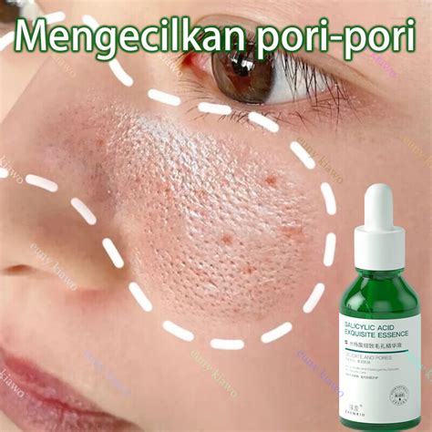 Jual Niacinamide Serum Salicylic Acid Serum Pengecil Pori Pori Serum