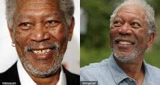 Celebrities with Dentures