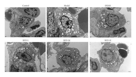 Morphology Of Lung Tissue Cells Observed By A Transmission Electron