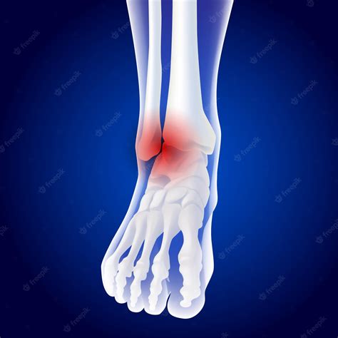 Premium Vector Educational Medical Illustration Of Foot Bones