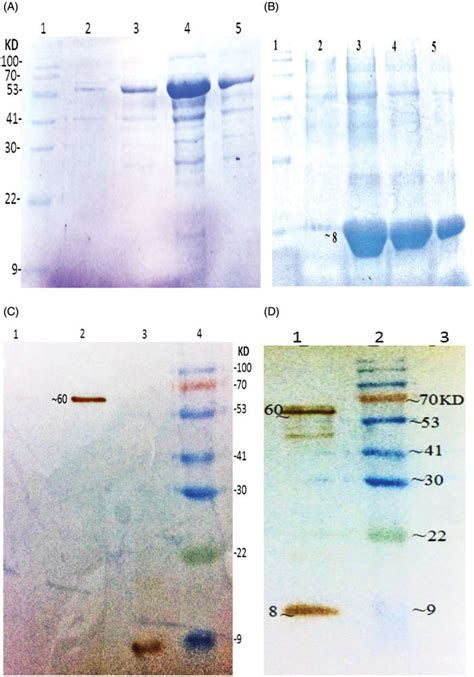 Purification And Western Blot Analysis Of Recombinant Protein A