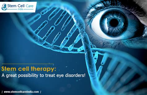 Is It Possible To Use Stem Cell Treatment For Eyes Home