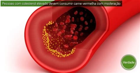 Sintomas De Excesso De Carne Vermelha - Carne vermelha em excesso é prejudicial à saúde? Veja mitos e verdades ...