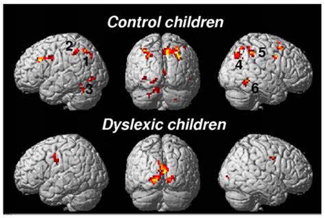 Brain Sciences Free Full Text The Neurological Basis Of