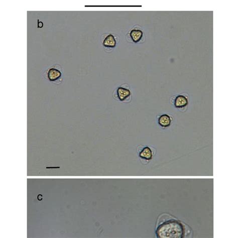 Neoactinomyxum Type CZ 1 A Line Drawing Of Mature Actinospores B