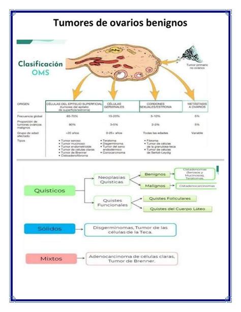 Tumores Benignos De Ovario Paola Ibarra Udocz