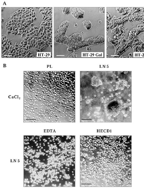 Laminin 5 Induces E Cadherin Mediated Intercellular Adhesion In Ht 29