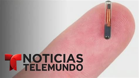 Implantan Microchips A Empleados De Una Empresa En Wisconsin