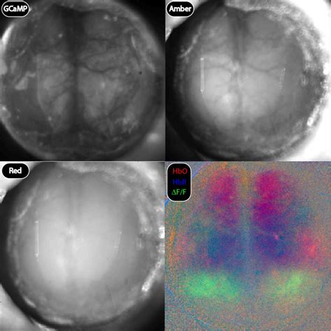 Modular Optical Imaging System Labeotech