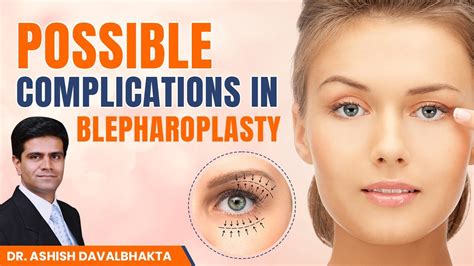 What Is Blepharoplasty Why Do You Need Blepharoplasty Possible Complications In