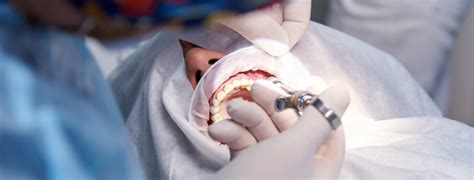 Necrosis pulpar Causas y consecuencias Clínica Dental en Toledo