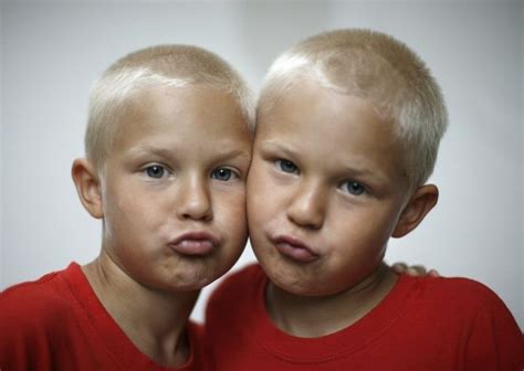 Twins Born Early Are Healthier Study