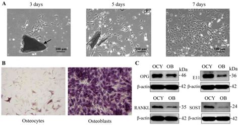 Radiation Induces Primary Osteocyte Senescence Phenotype And Affects