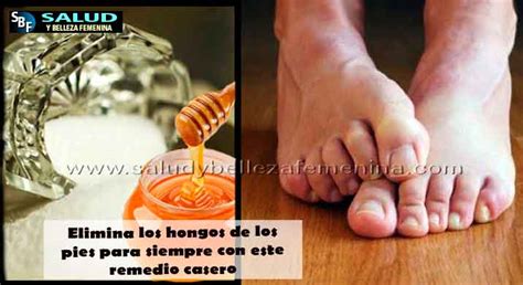 Elimina Los Hongos De Los Pies Para Siempre Remedios Y Tratamientos