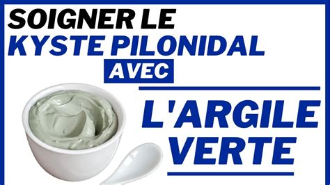 Comment Soigner Le Kyste Pilonidal Avec L Argile Verte Youtube