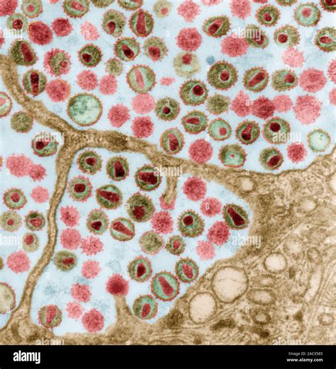 Hiv Infected Cell Coloured Transmission Electron Micrograph Tem Of