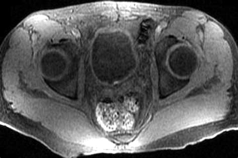 Mr Urography Techniques And Clinical Applications Radiographics