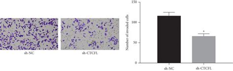 Silencing CTCFL Hinders Cell Malignant Behaviors In Gastric Cancer