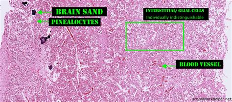 pineal-gland-slide-labelled-histology | SchoolWorkHelper