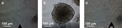 Optical pictures of human dermal fibroblast in various growth ...